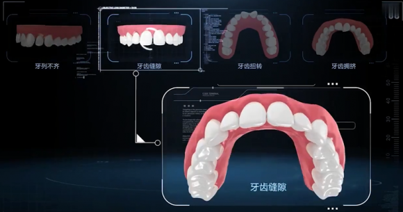 广州中家医口腔：AI全智能护齿迎新年健康笑容新体验(图4)